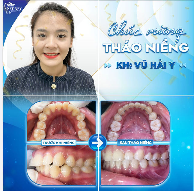 CHÚC MỪNG THÁO NIỀNG KH. HẢI YẾN