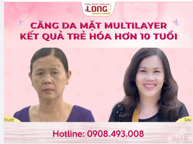 MỘT KHUÔN MẶT 2 SỐ PHẬN SẼ LÀ NHƯ THẾ NÀO?