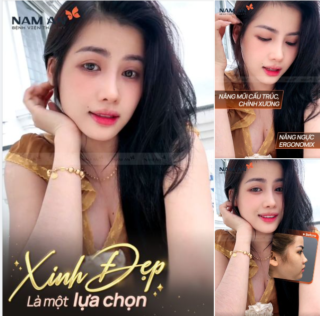 XINH ĐẸP SAU NÂNG MŨI - NÂNG NGỰC