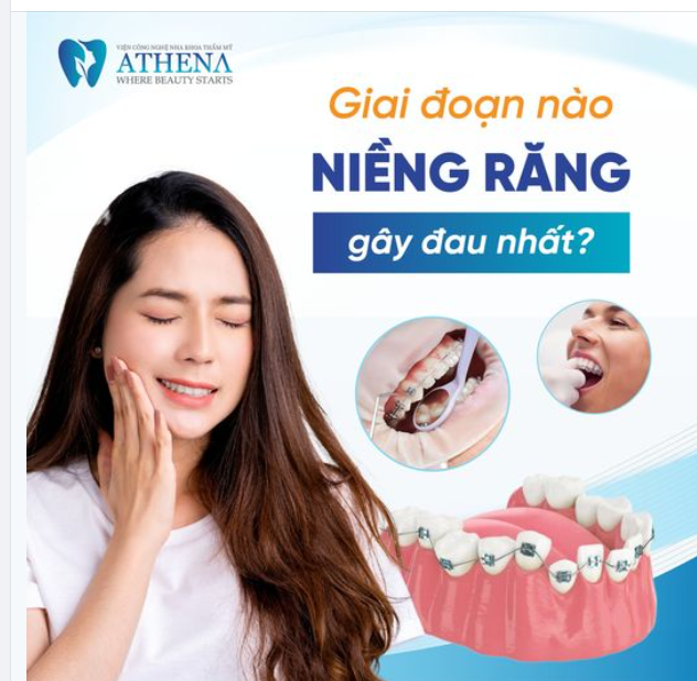 Niềng răng đau nhất lúc nào?