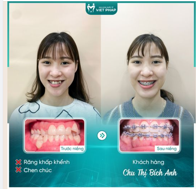 THAY ĐỔI ĐỂ XINH ĐẸP - CHƯA BAO GIỜ LÀ QUÁ MUỘN