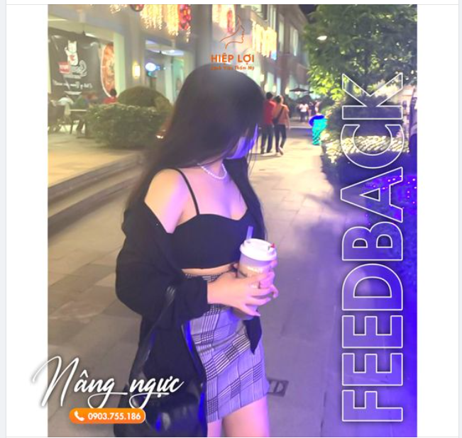 Feedback hình ảnh "vòng một" được gửi từ khách yêu