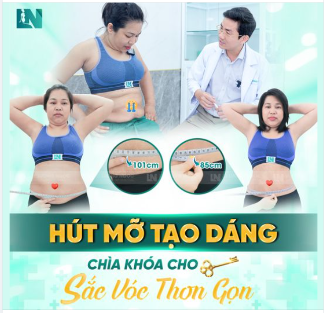 TIẾNG LÀNH ĐỒN XA, được một người chị giới thiệu về sự hiệu quả sau khi thực hiện hút mỡ tạo dáng không cần căng cắt da bởi Ekip của Bác sĩ Lương Ngọc