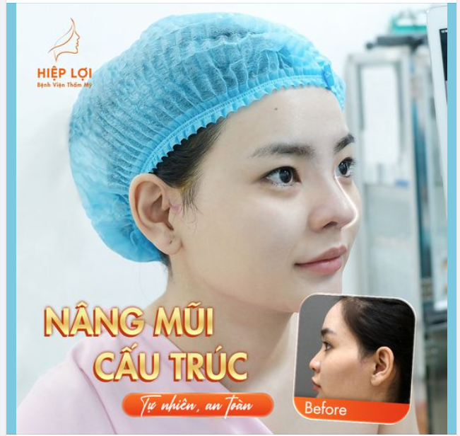 Nâng mũi cấu trúc – Lựa chọn "hoàn hảo" để mang lại vẻ đẹp "tự nhiên" và sự "tự tin"