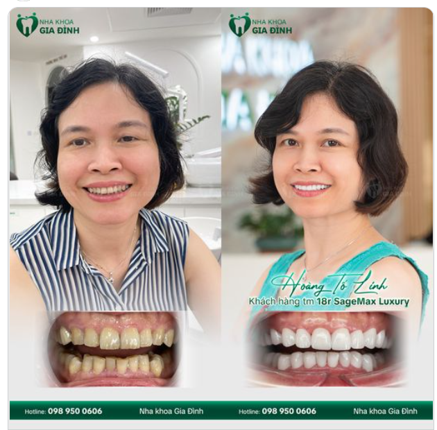 CHỊ KHÁCH HÀNG THÂN THIẾT 10 NĂM QUYẾT ĐỊNH TÂN TRANG NỤ CƯỜI