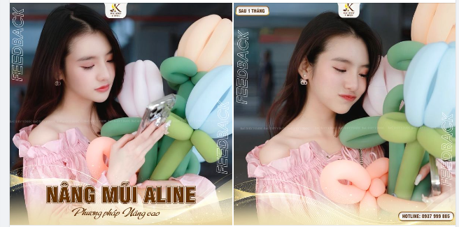 NHAN SẮC ẤN TƯỢNG SAU 1 THÁNG NÂNG MŨI ALINE