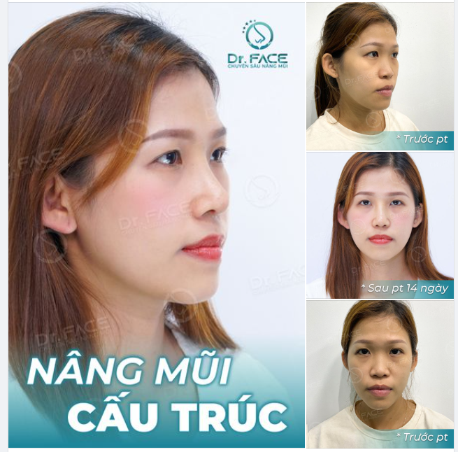 Hôm nay em bận yêu mình. Hẹn anh hôm khác chúng mình yêu nhau…!