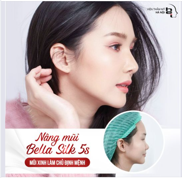 Nâng mũi BELLA SILK 5S - MŨI XINH LÀM CHỦ ĐỊNH MỆNH