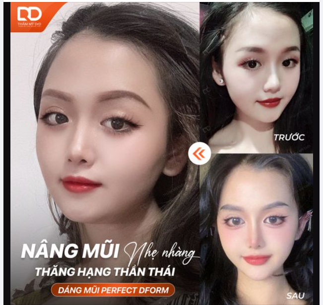 NÂNG MŨI NHẸ NHÀNG - THĂNG HẠNG THẦN THÁI