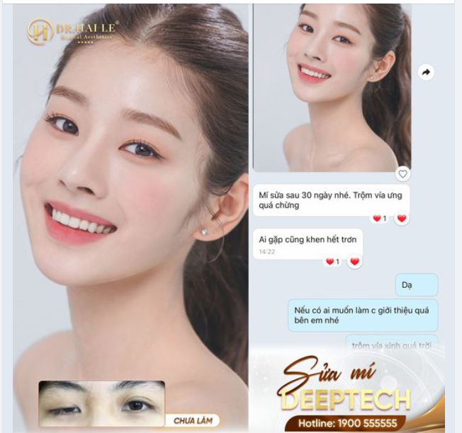 "Trăm nghe không bằng một thấy, trăm thấy không bằng tự mình trải nghiệm. Mí sửa sau 30 ngày không có điểm gì để chê luôn" chị Khách chia sẻ