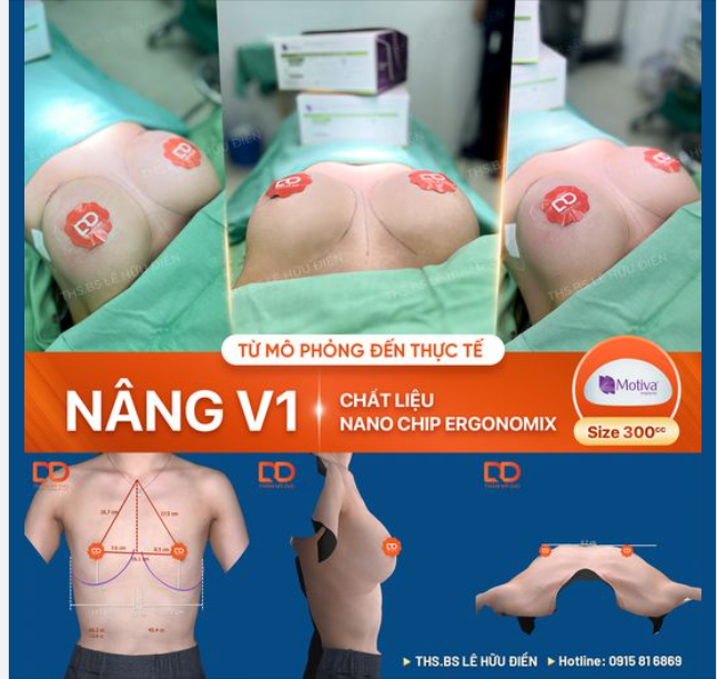 MUỐN NGỰC ĐẸP PHẢI CHUẨN TỪ LÚC CHỌN SIZE