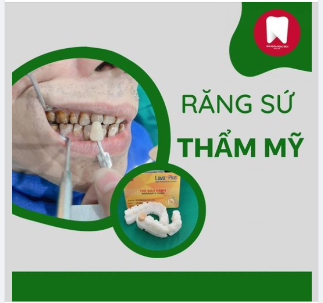 ỨNG DỤNG CÔNG NGHỆ SCAN 3D TRONG PHỤC HÌNH NHA KHOA