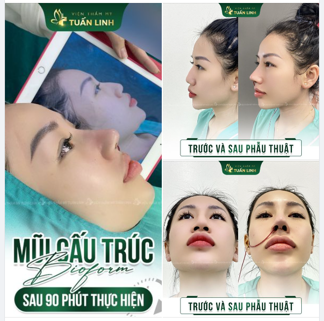 3 LÝ DO KHIẾN KHÁCH HÀNG TIN TƯỞNG & LỰA CHỌN TUẤN LINH