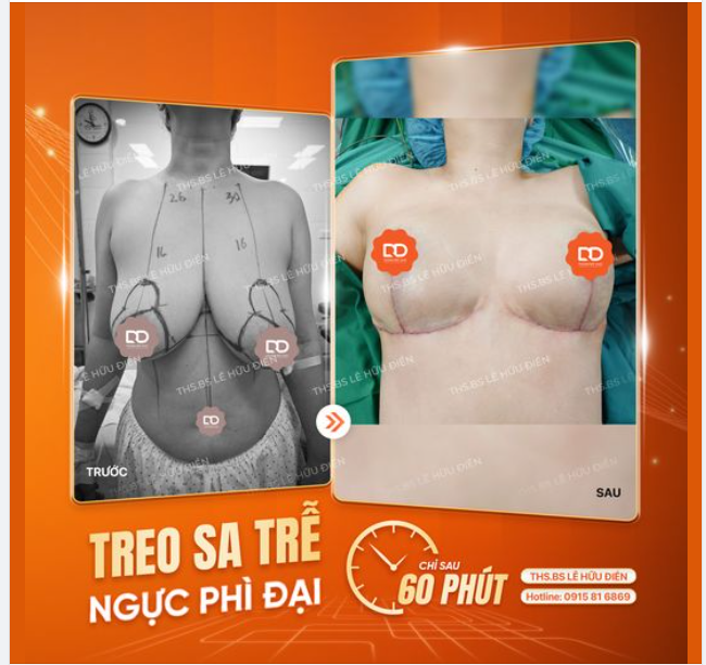 CA PHẪU THUẬT V1 HÔM NAY CỦA BÁC SĨ ĐIỀN VÀ EKIP CÓ GÌ ĐẶC BIỆT?