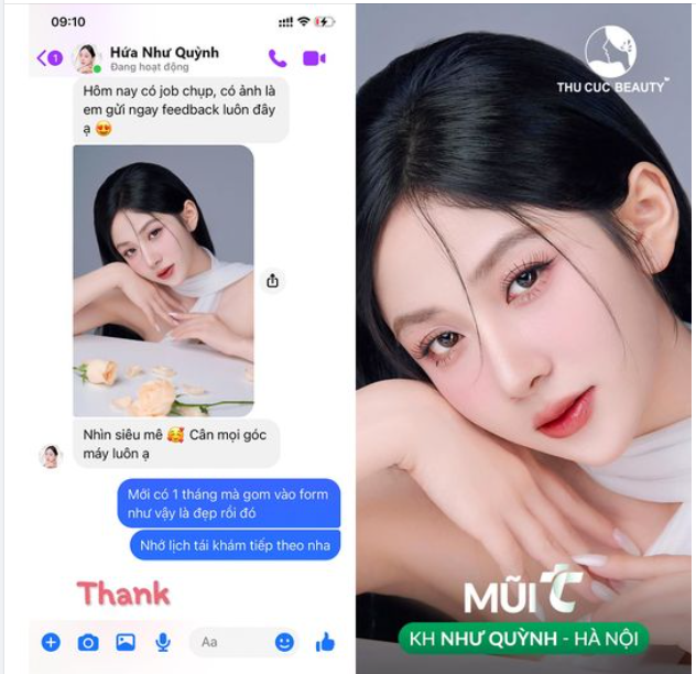 Feedback nâng mũi sau 1 tháng siêu ưng của KH Hứa Như Quỳnh - Hà Nội