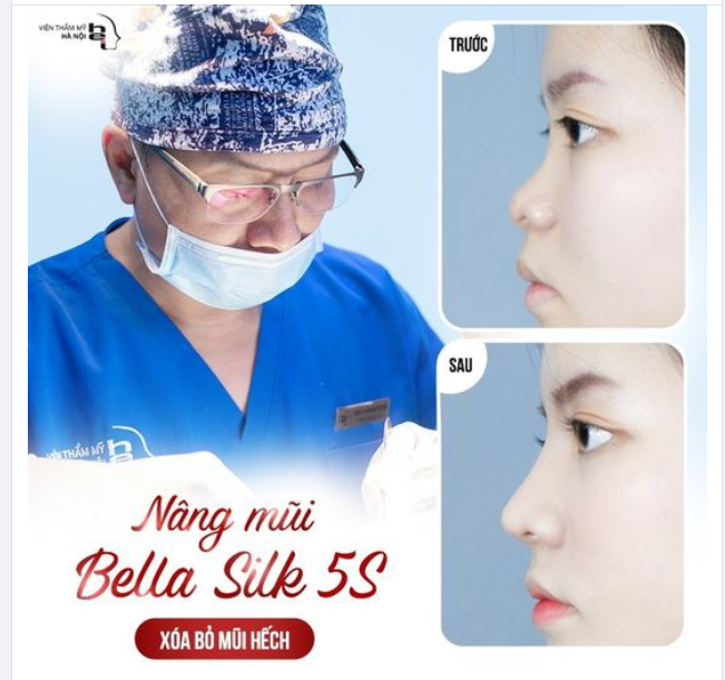 NÂNG MŨI BELLA SILK 5S - XOÁ BỎ MŨI HẾCH