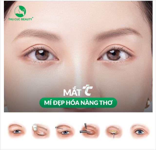 Rất nhiều khách hàng đã "hối hận" khi không cắt mí sớm hơn. Còn bạn thì sao?