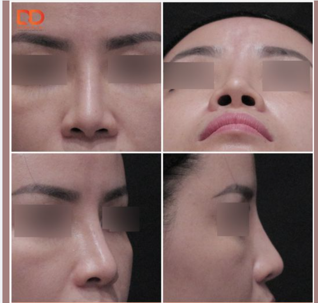 CẬP NHẬT HÌNH ẢNH TRƯỚC PHẪU THUẬT