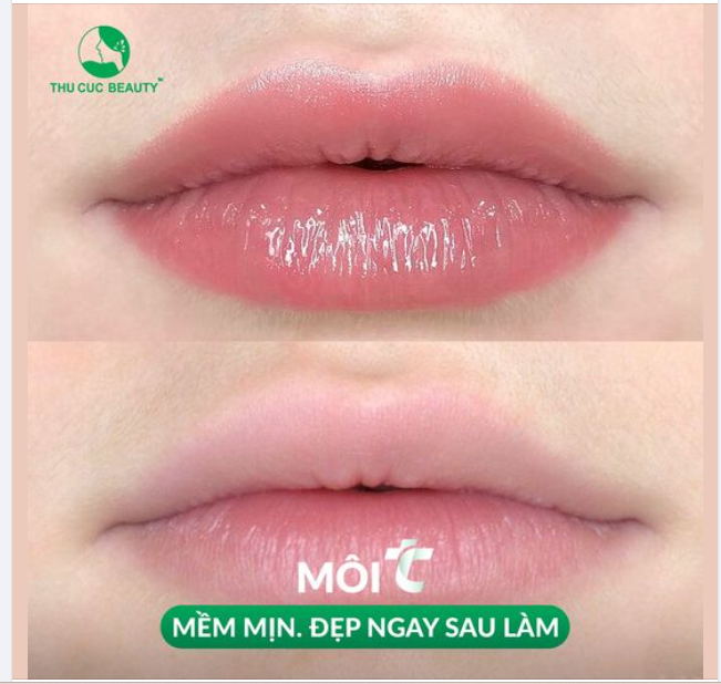 Loại bỏ đôi môi nhạt màu, môi thâm thiếu sức sống