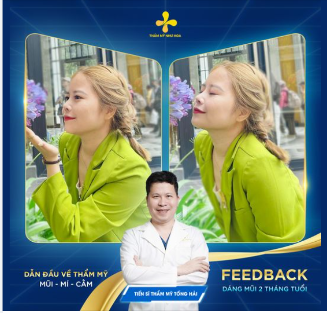 Một chiếc feedback xinh từ chị kế toán sau 2 tháng nâng mũi cấu trúc Sline