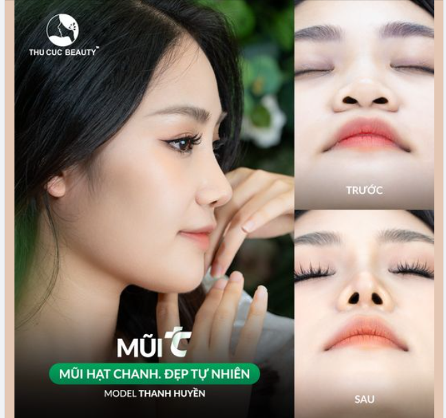 Bí quyết để sở hữu mũi hạt chanh, hài hòa gương mặt chuẩn tỷ lệ vàng
