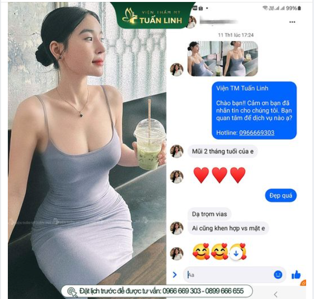 "Dáng mũi em sau 2 tháng...Ai cũng khen đẹp, hợp mặt" - Feedback mũi cấu trúc của khách hàng nhà Tuấn Linh.