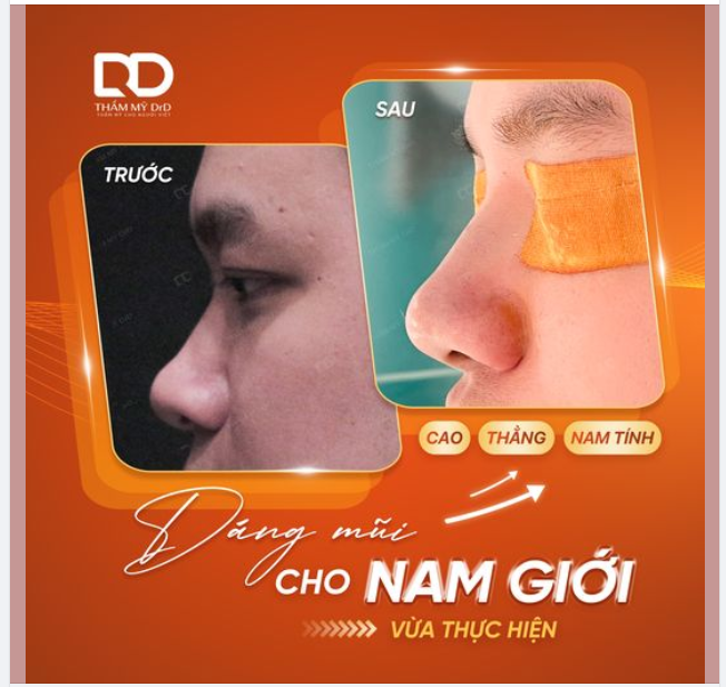 AI RỒI CŨNG LÀM ĐẸP Trong khi phái NỮ yêu thích dáng mũi nhẹ nhàng với những đường nét mềm mại.