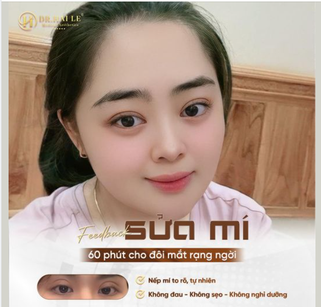 Trót cắt mí tại cơ sở kém uy tín để rồi nhận cái kết “chan chứa nước mắt”