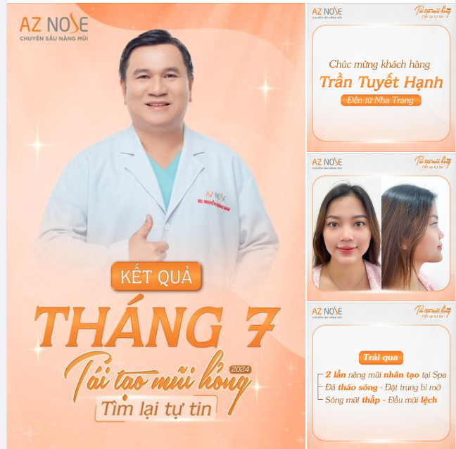 Tái tạo mũi hỏng 2024 Chúc mừng khách hàng Trần Tuyết Hạnh đến từ Nha Trang