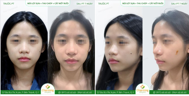 Không làm thì thôi, một khi đã làm thì phải làm cho trọn vẹn