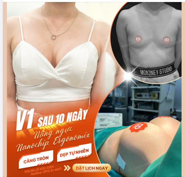 VÒNG 1 CĂNG TRÒN - TỰ NHIÊN CHỈ SAU 10 NGÀY.