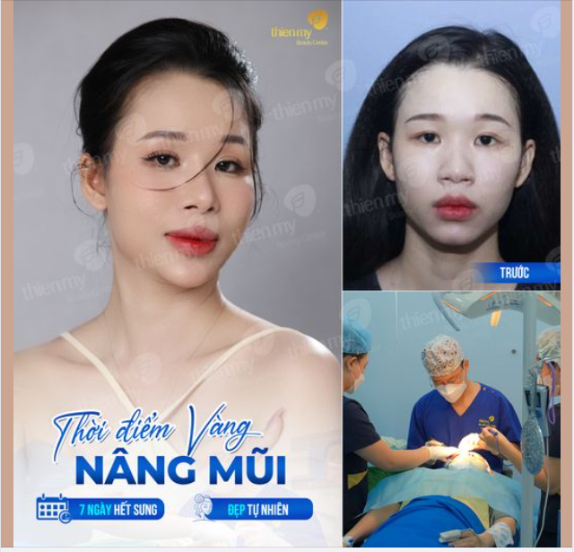 “Tái sinh” đầu mũi ngắn, hếch,thô, to, của khách hàng. Mang tới diện mạo mới tự nhiên, bền vững theo thời gian