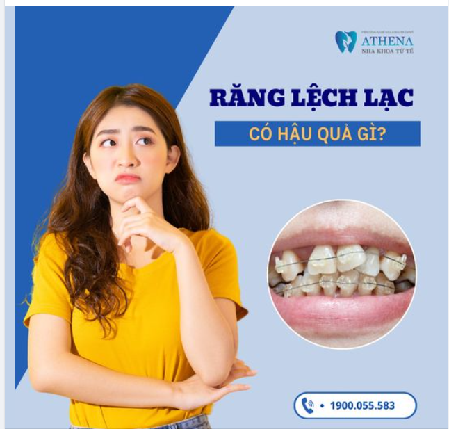Răng lệch lạc để lại những hậu quả gì?