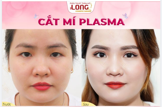 ANH TRAI VƯỢT NGÀN CHÔNG GAI Vẫn khó mà cai được ánh nhìn này.