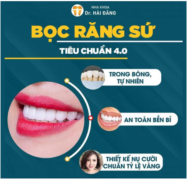 Bọc răng sứ tiêu chuẩn 4.0