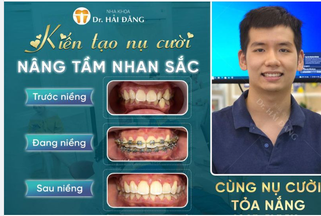 KIẾN TẠO NỤ CƯỜI NÂNG TẦM NHAN SẮC