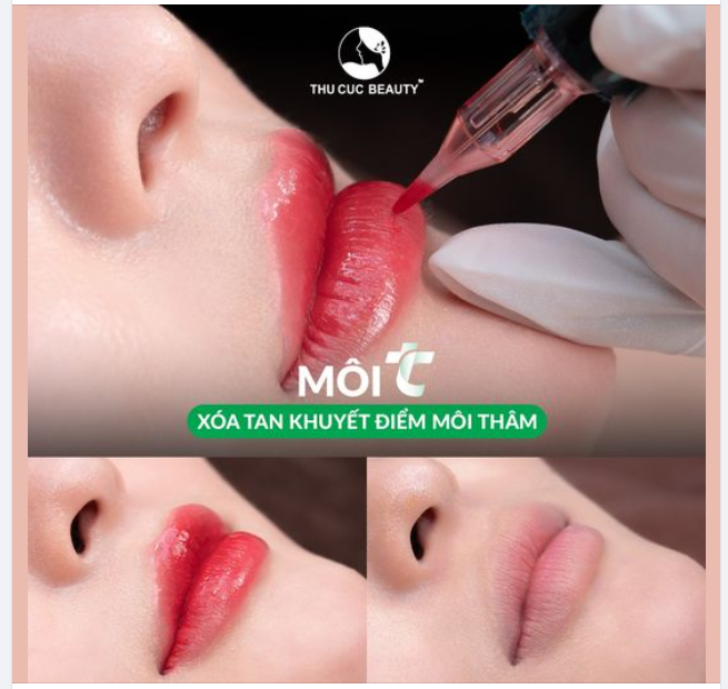 Xóa tan khuyết điểm môi thâm nhờ công nghệ phun xăm TC