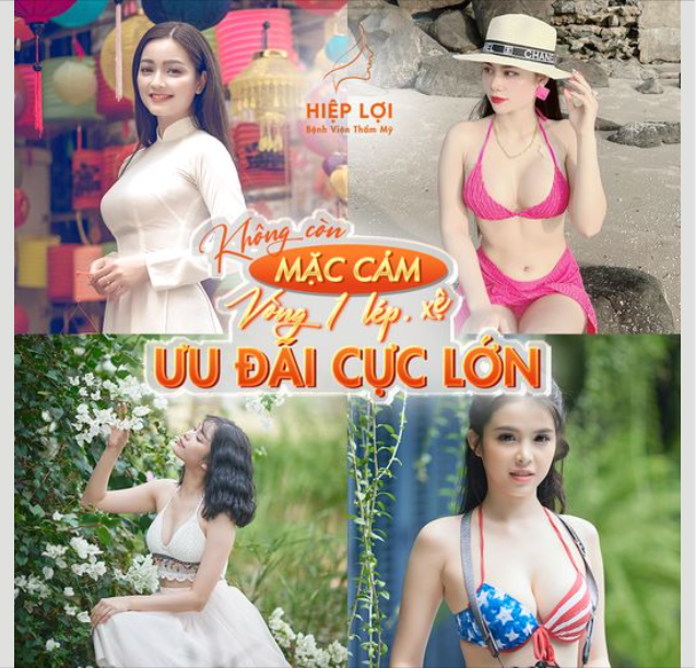 Không còn "mặc cảm" với vòng 1 "lép, xệ"
