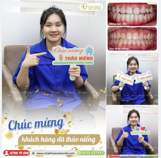 CHÚC MỪNG KHÁCH HÀNG ĐÃ THÁO NIỀNG