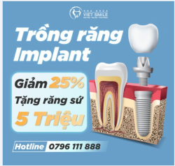 ƯU ĐÃI CẤY GHÉP IMPLANT - NHANH TAY ĐĂNG KÝ NHẬN HÀM RĂNG NHƯ Ý