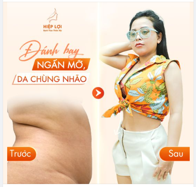 Hình ảnh khách hàng thực tế trước/sau tại BVTM Hiệp Lợi