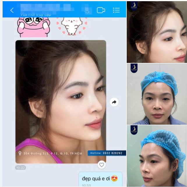 Tìm được dáng mũi tự nhiên, hợp mặt với mình là một điều hạnh phúc phải không các bạn