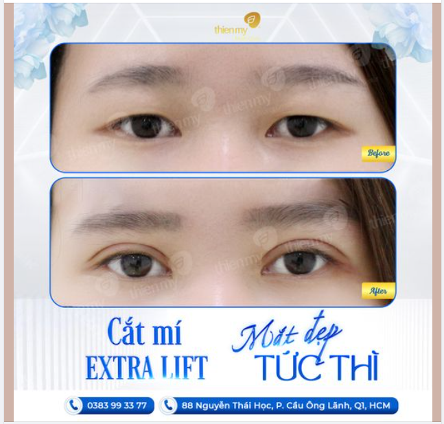 Chạm nhầm 1 ánh mắt , cơn say cả cuộc đời