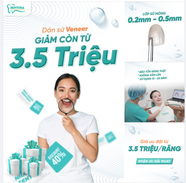 KHẮC HỌA NỤ CƯỜI CÙNG SỨ VENEER GIẢM CÒN TỪ 3.5 TRIỆU/RĂNG