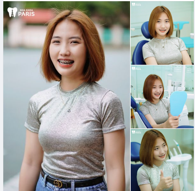 NIỀNG RĂNG ĐÃ THAY ĐỔI HOÀN TOÀN CUỘC SỐNG CỦA MÌNH