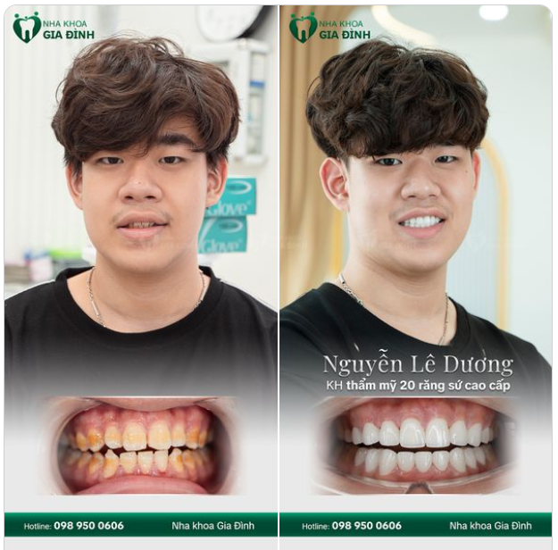 CHÀNG TRAI 20 THAY ĐỔI NỤ CƯỜI VÀ NIỀM VUI CHỢT ĐẾN