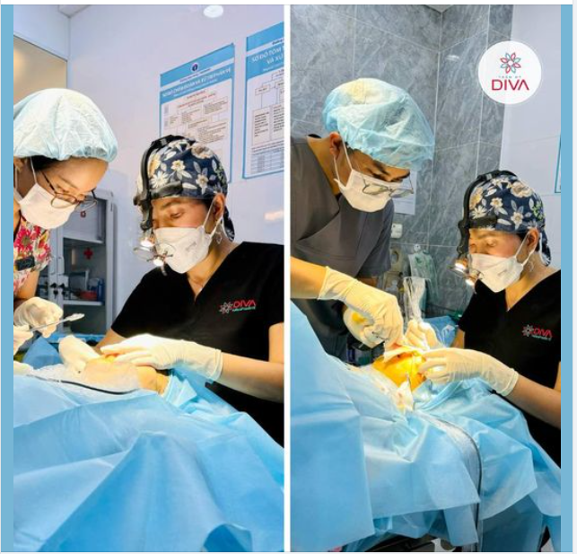 TÚI MỠ MÍ DƯỚI, NÊN ƯU TIÊN LOẠI BỎ VÌ SAO?