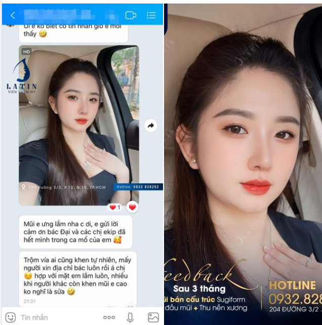 Feedback mũi cấu trúc 3 tháng tuổi từ em gái Bình Phước
