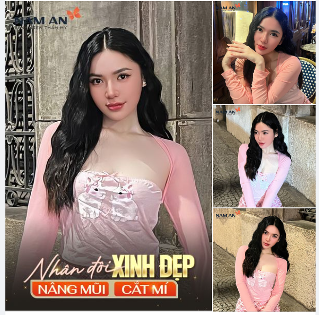 NHÂN ĐÔI XINH ĐẸP SAU NÂNG MŨI CẮT MÍ