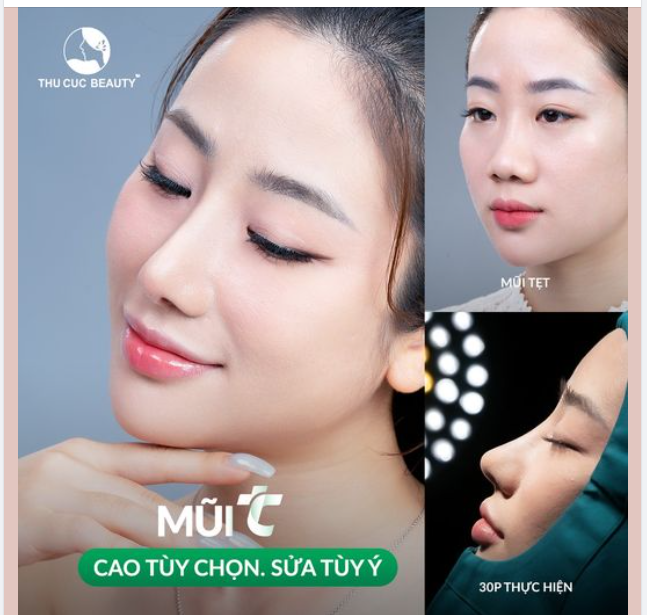 Đến TC bạn có ngay bí quyết để loại bỏ sống mũi tẹt, đầu mũi hếch?